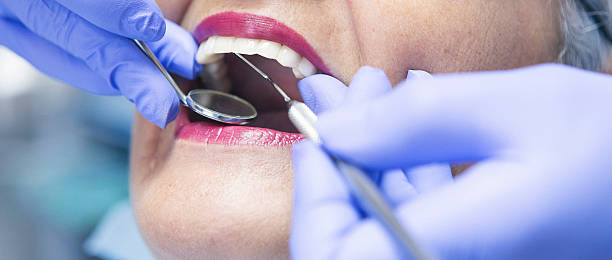 Best Emergency Wisdom Teeth Removal in Lakeview, OR